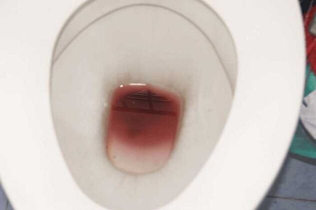 Sichtung bei Männern, wenn sie aufgeregt sind